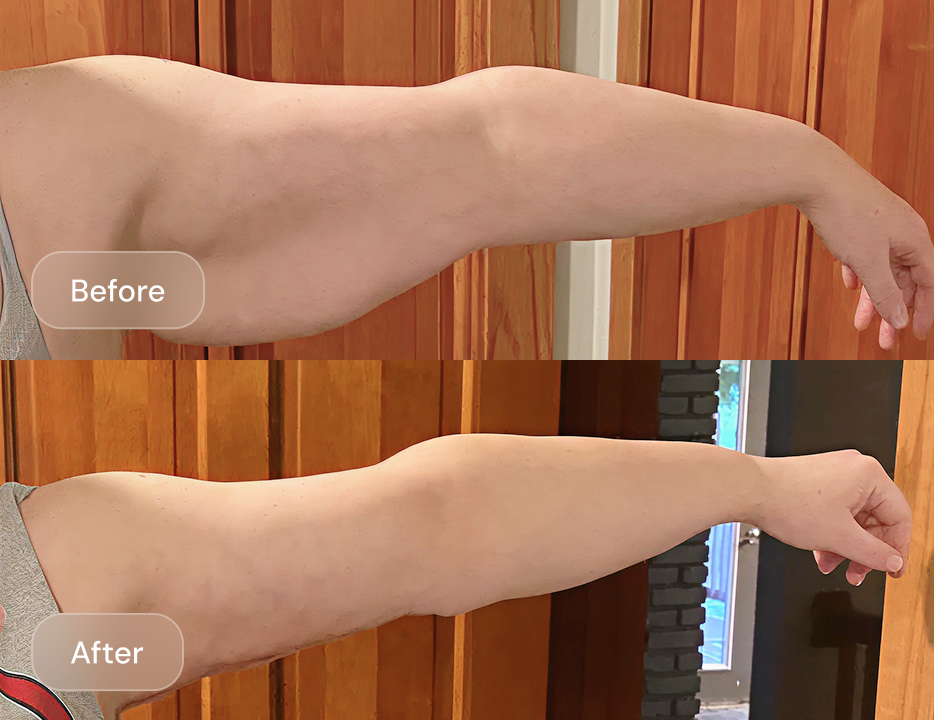 Client result