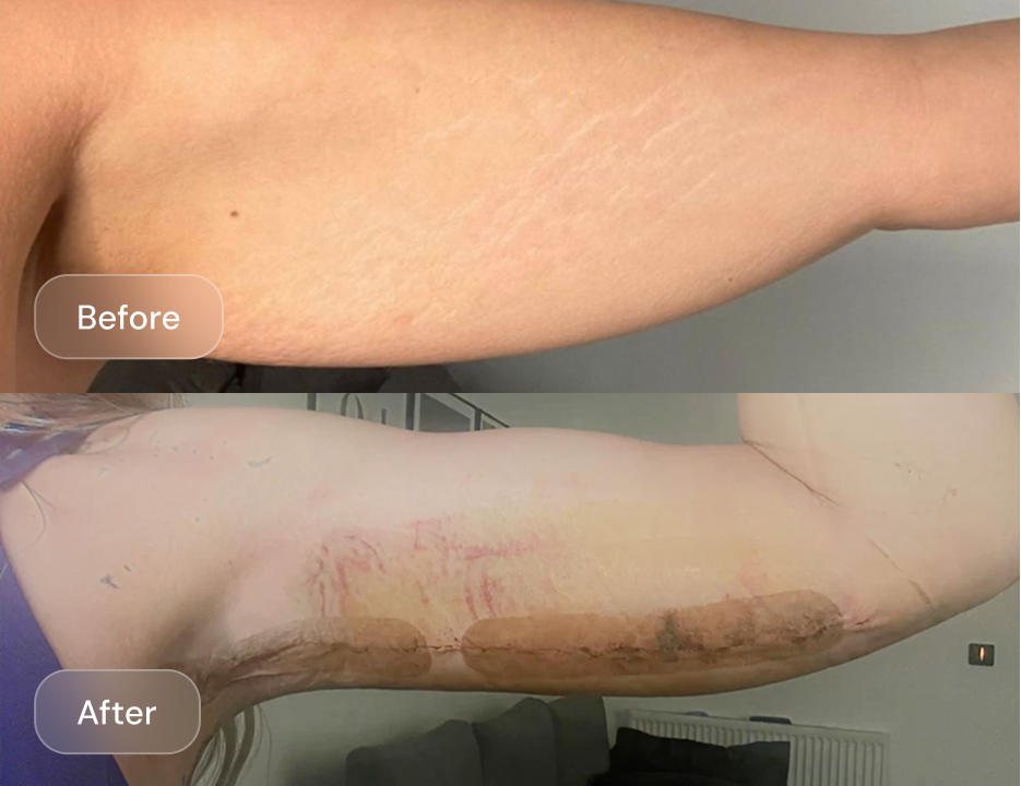Client result