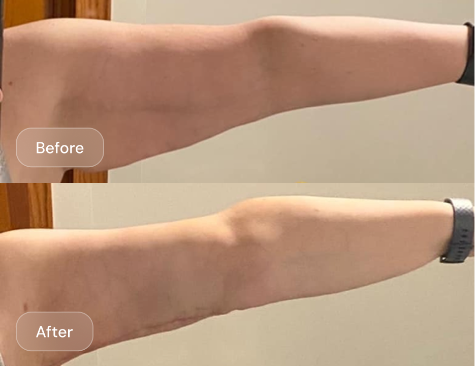 Client result