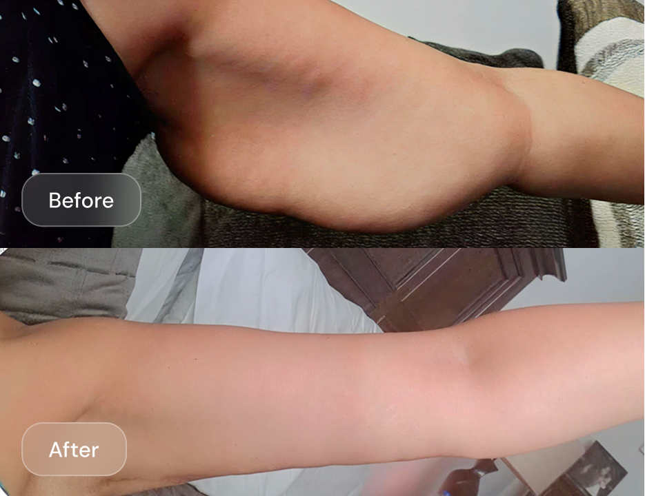 Client result