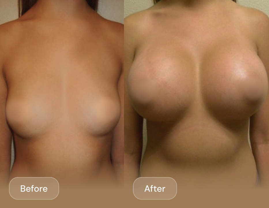 Client result