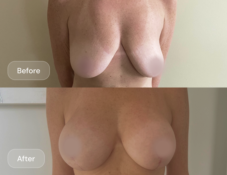 Client result