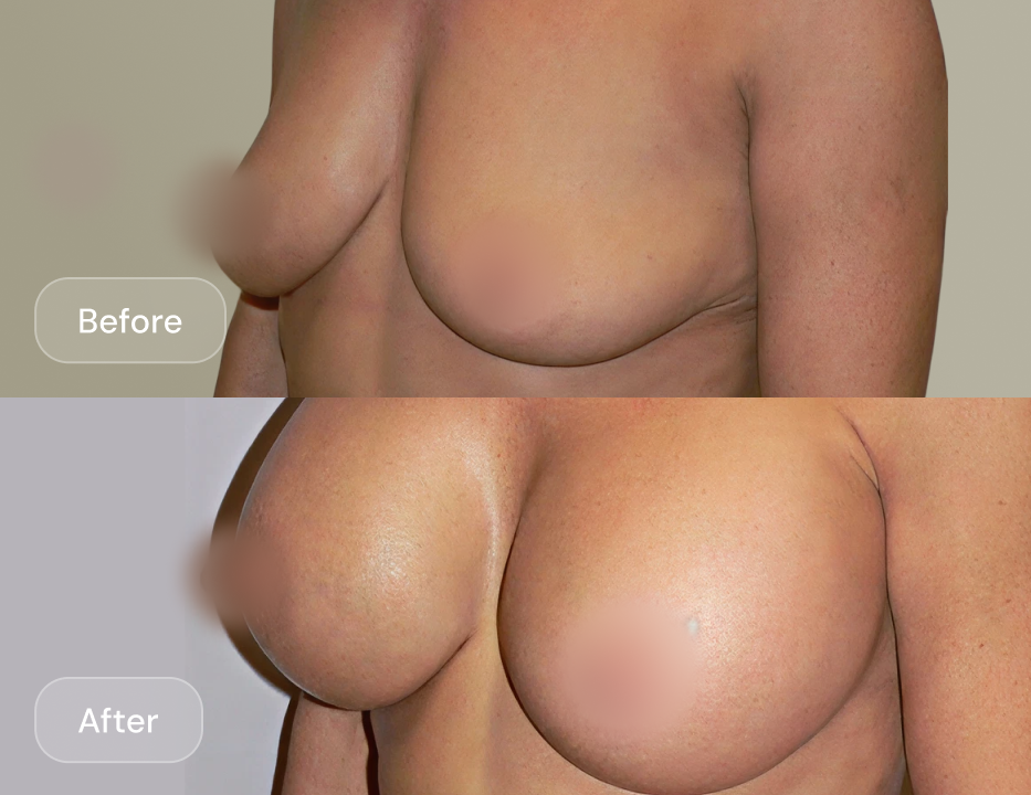 Client result