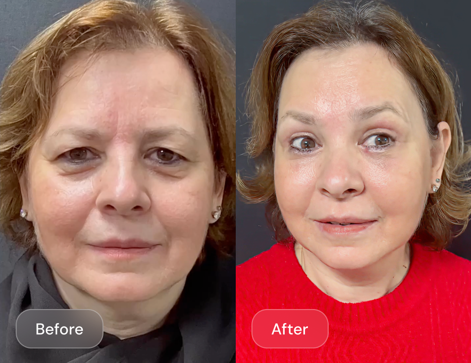 Client result
