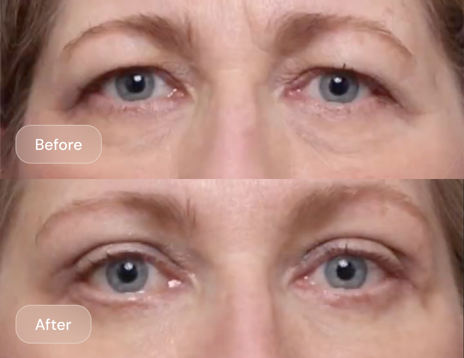 Client result