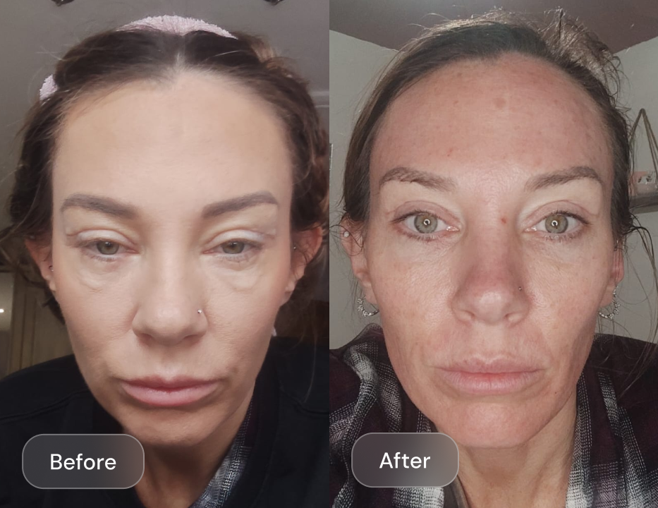 Client result