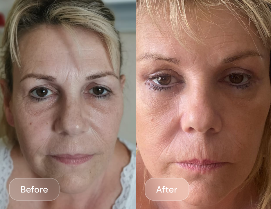 Client result