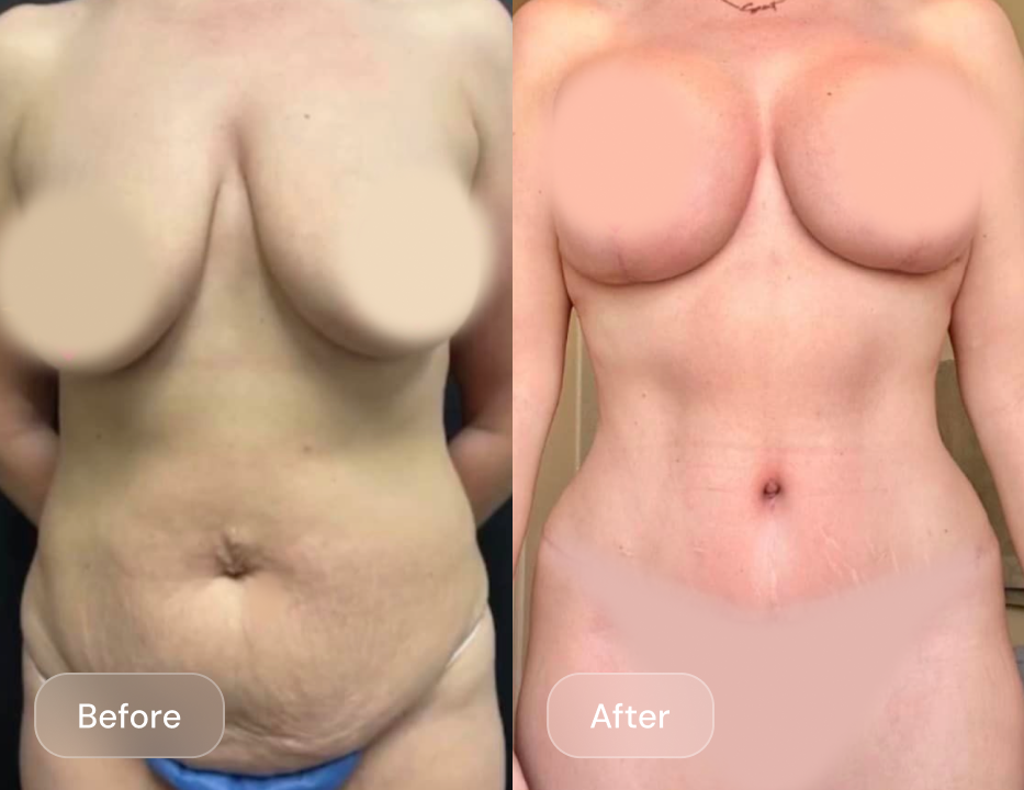 Client result