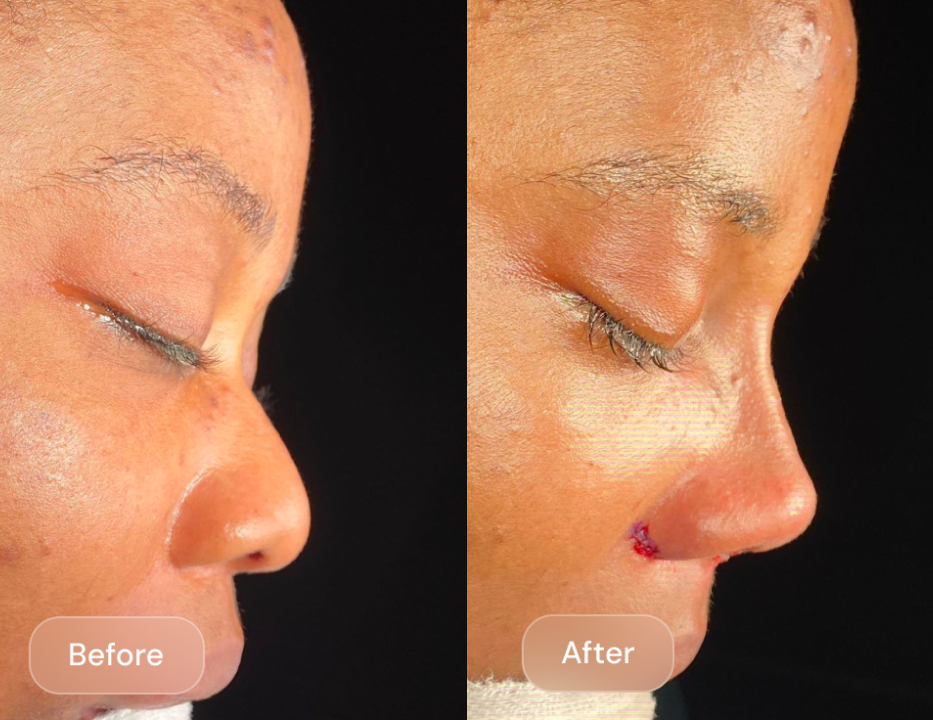 Client result