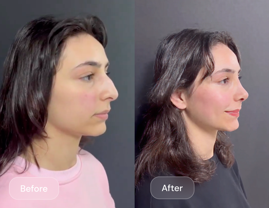 Client result