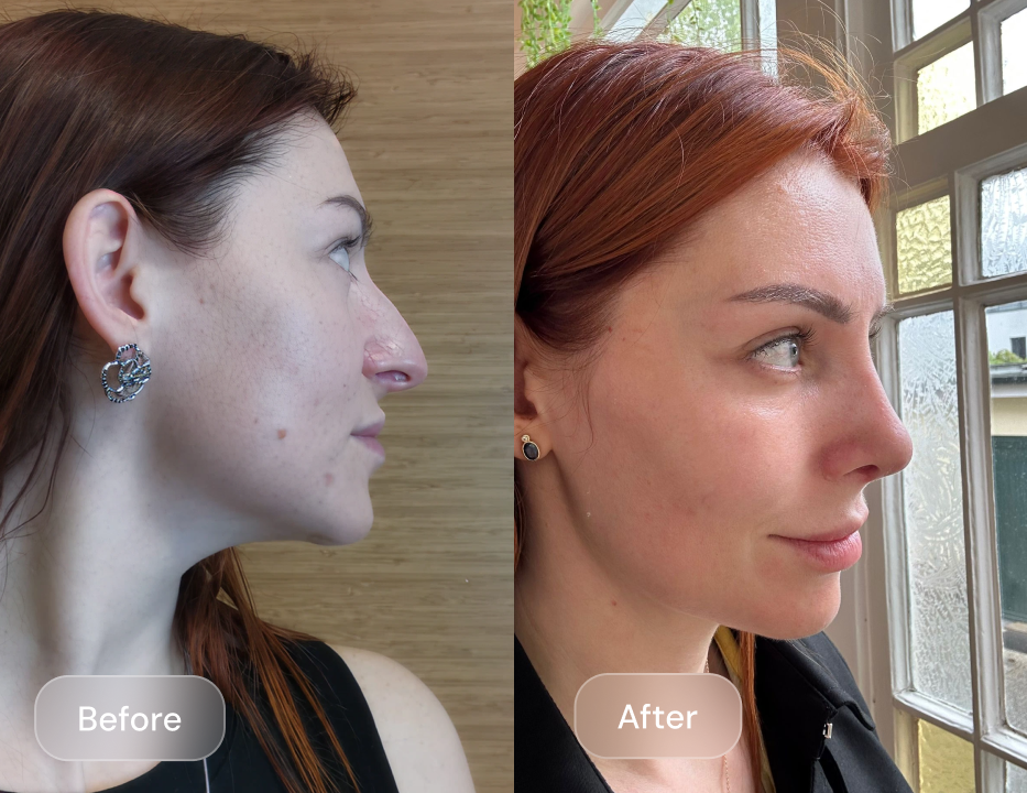 Client result