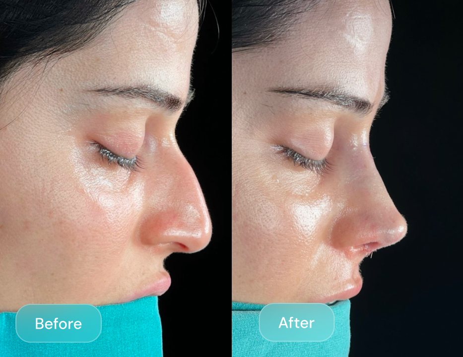 Client result