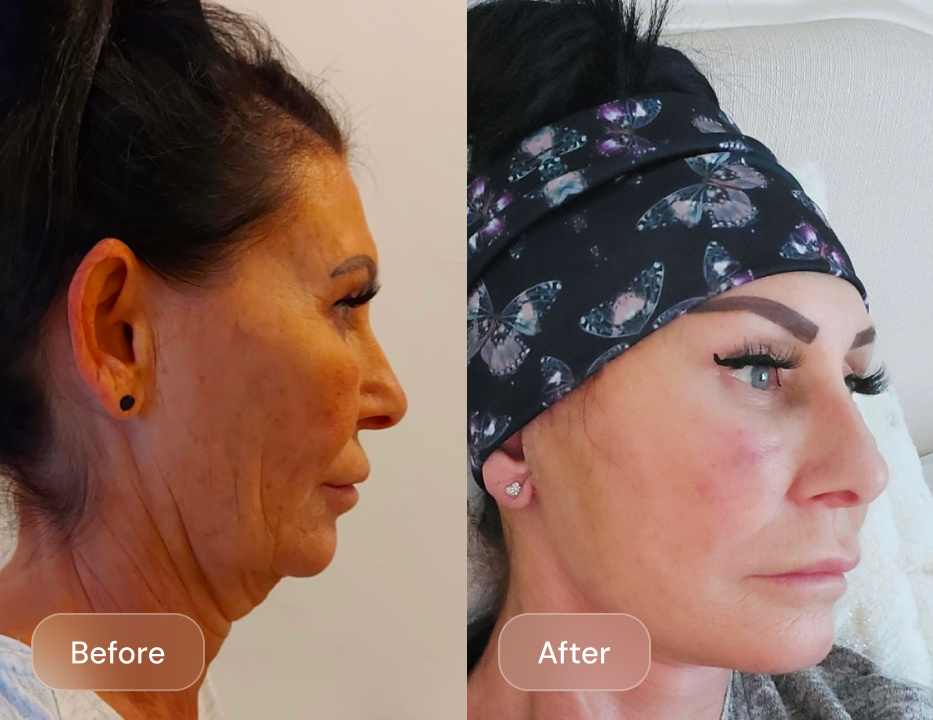Client result