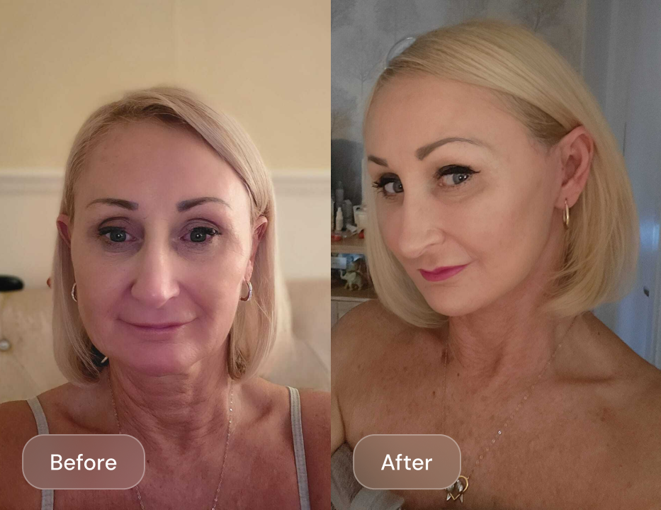 Client result
