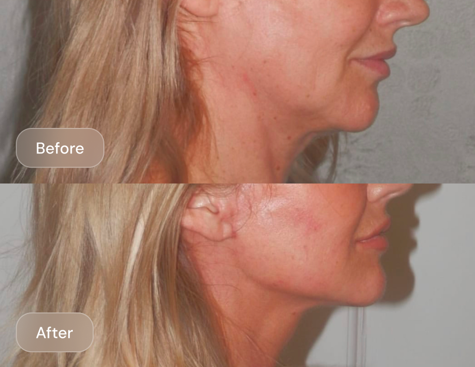 Client result