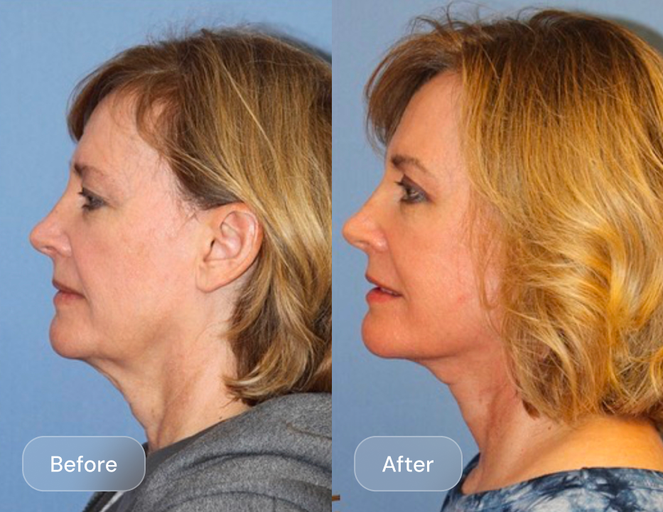 Client result