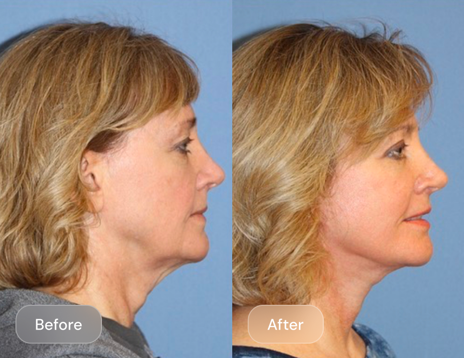 Client result