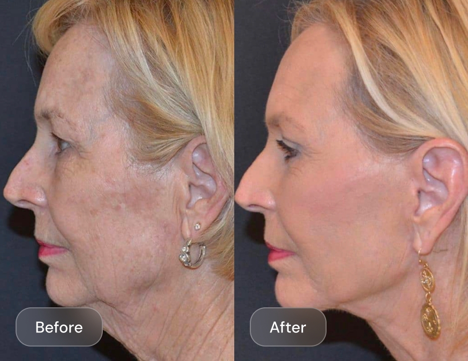 Client result