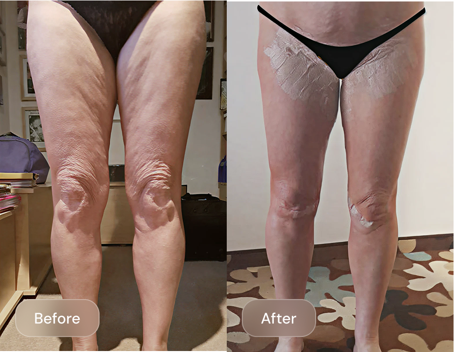 Client result