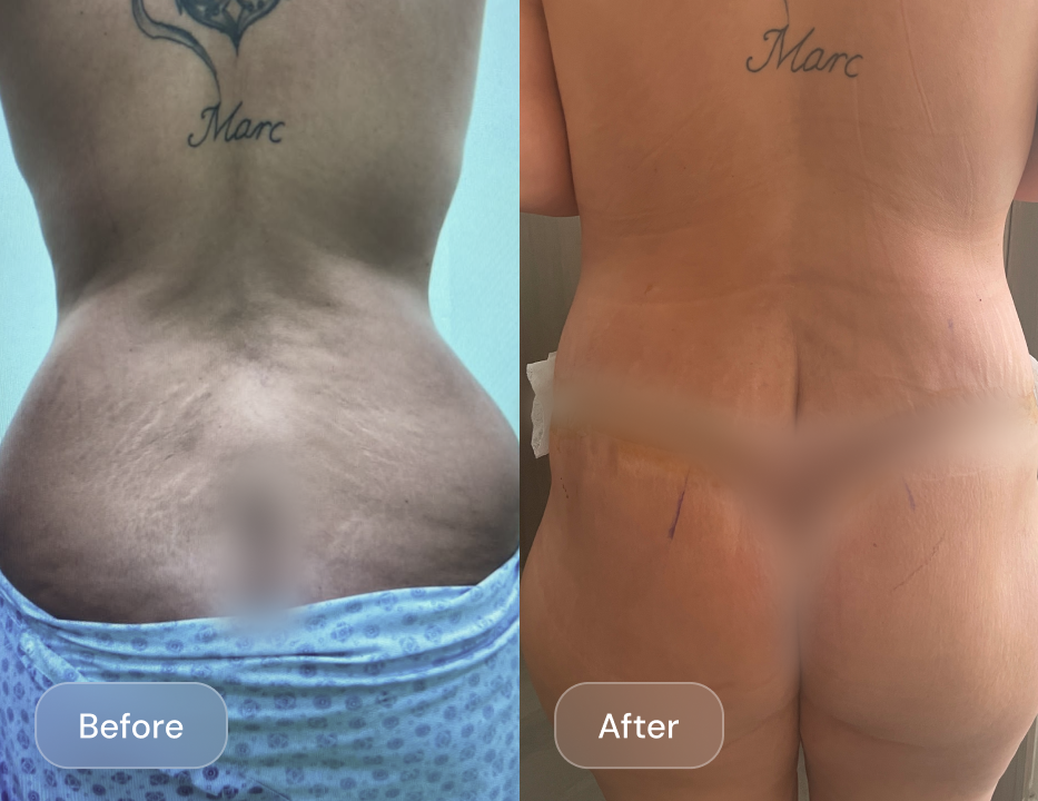 Client result