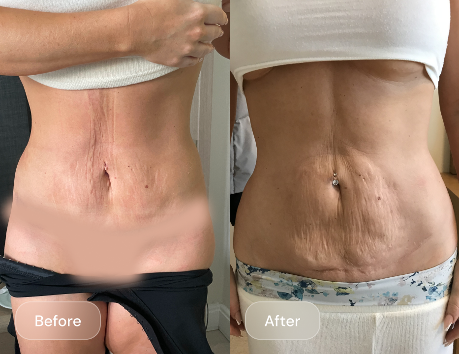 Client result