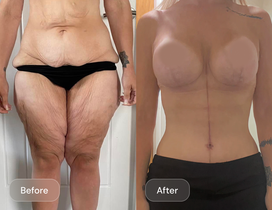 Client result